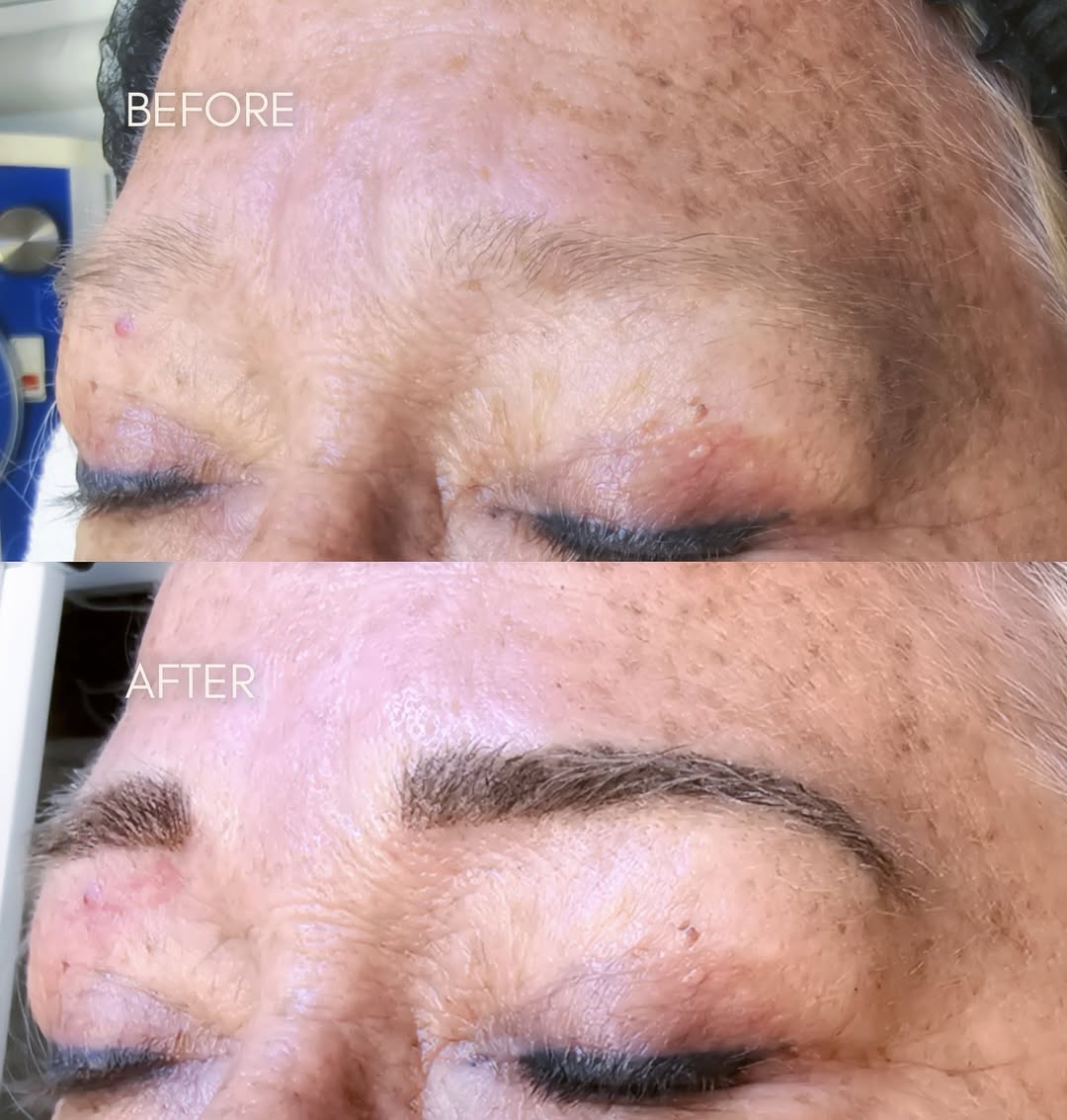 Before and after brow microblading