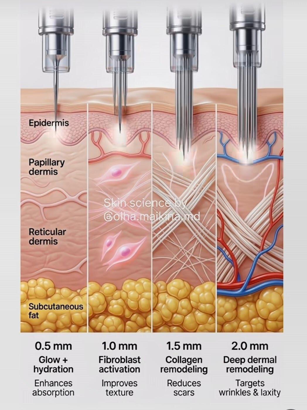 Microneedling